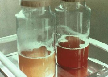 hématurie de l'effort ultra-trail