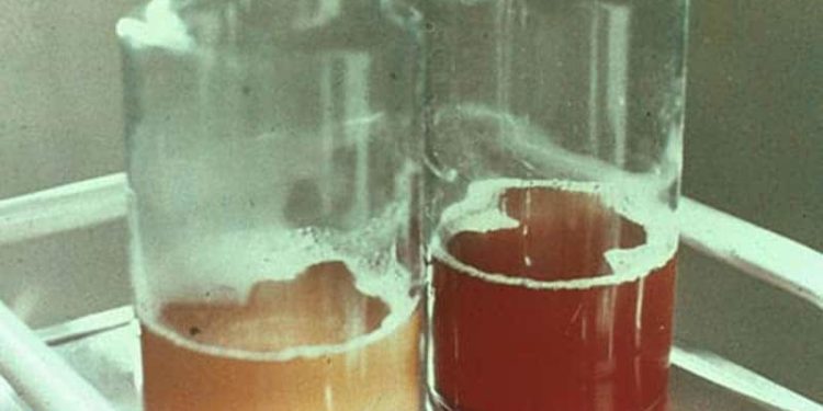 hématurie de l'effort ultra-trail