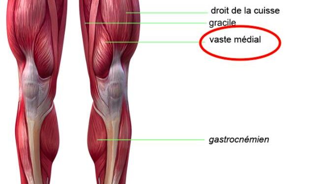 Le vaste médial…. vous connaissez ?