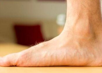 Trail : Quelles chaussures quand on a les pieds plats