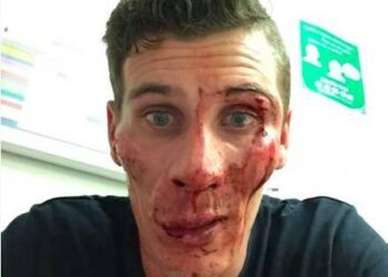 Pierre Ambroise Bosse mis en examen : la justice devra trancher, qui dit la vérité ?