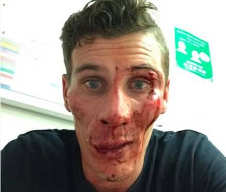 Pierre Ambroise Bosse mis en examen : la justice devra trancher, qui dit la vérité ?