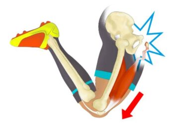 Entrainement trail & blessures en séries !
