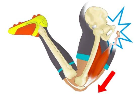 Entrainement trail & blessures en séries !