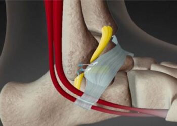 blessure cheville chaussure de trail