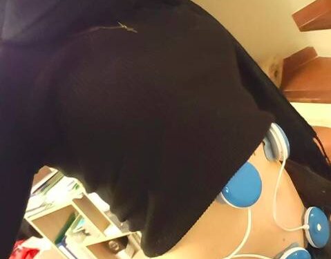 electrostimulation trail