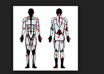 blessure trigger points trail