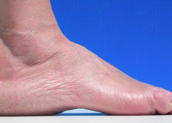 chaussure de trail pied creux se muscler le pied quand on fait du trail