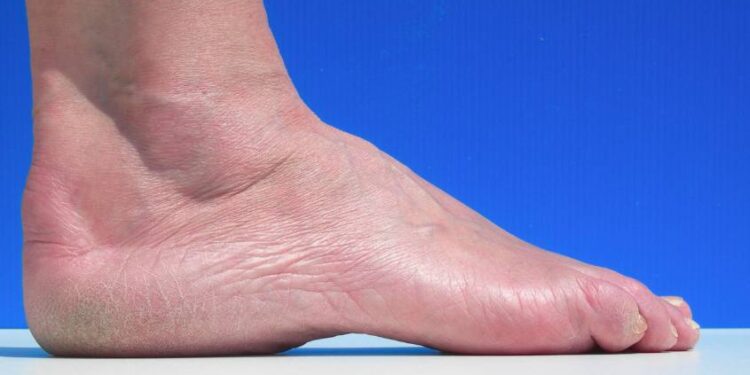 chaussure de trail pied creux se muscler le pied quand on fait du trail