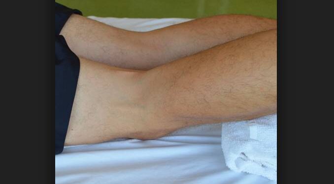 creux poplité trail