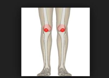 syndrome rotulien trail