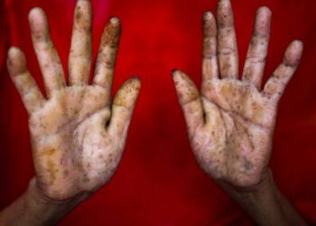 Toute l’actualité trail du vendredi 5 juillet