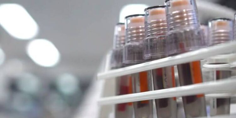 dopage espagne ultra-trails