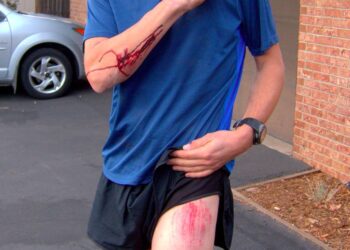 Comment réagir quand on croise un traileur blessé ?