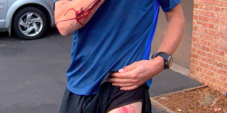 Comment réagir quand on croise un traileur blessé ?