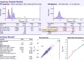 La VFC est la variabilité de la Fréquence Cardiaque