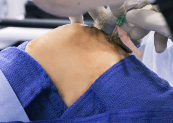 injections PRP trail