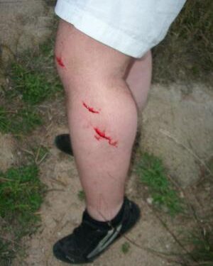 OFF : faire du trail dans les ronces, comment faire ?