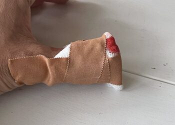 blessure kilian jornet