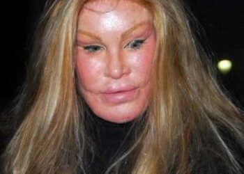 Trail : nouveau ratage à la Réunion