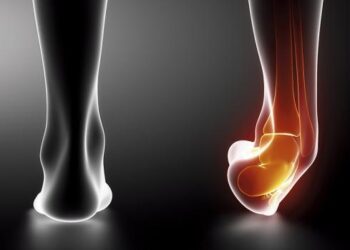 entorse protocole GREC