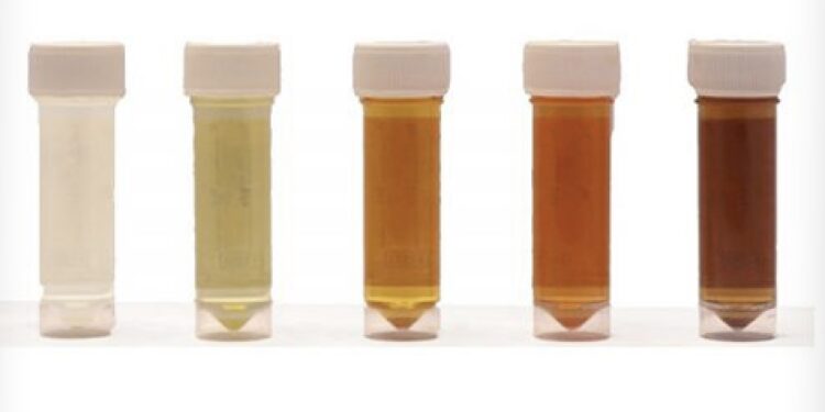 Dopage : des traileurs testés sans le savoir