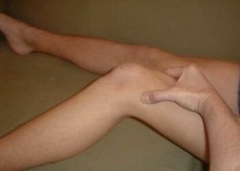 syndrome de l'essuie glace