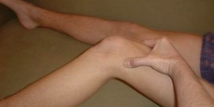 syndrome de l'essuie glace