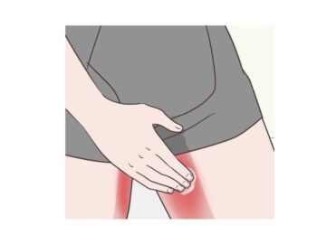 irritations course à pied