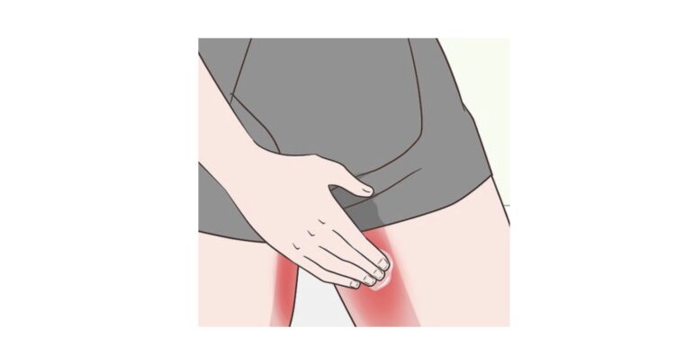 irritations course à pied